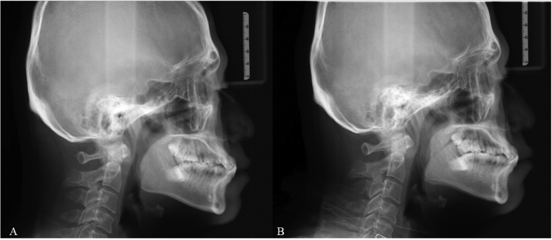 Fig. 6