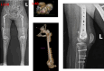 Fig. 13