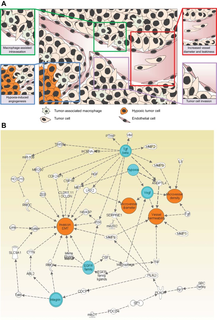 Tumor cell intravasation - PMC