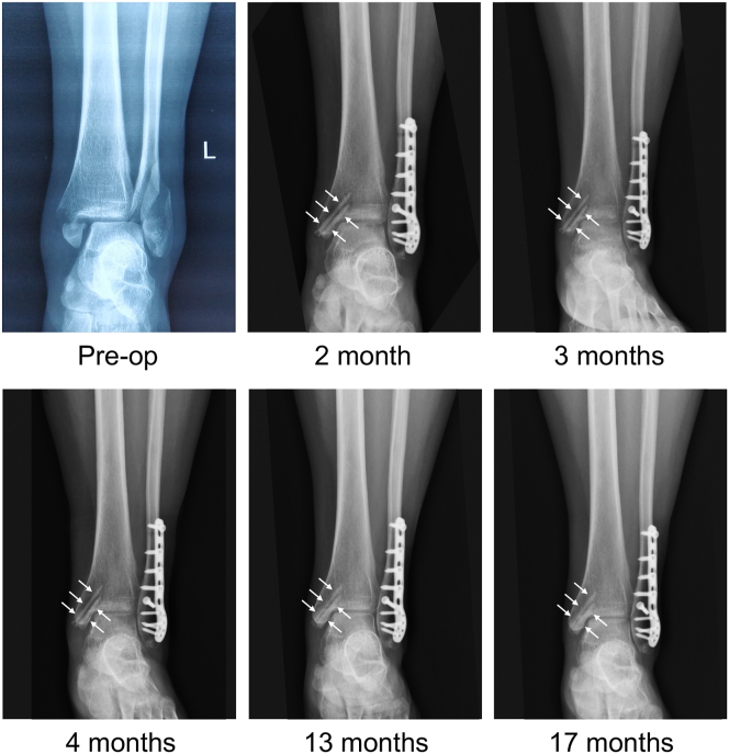 Figure 2