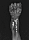 Fig. 5