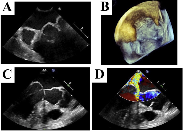 Figure 3