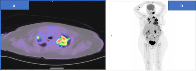 Fig. 2