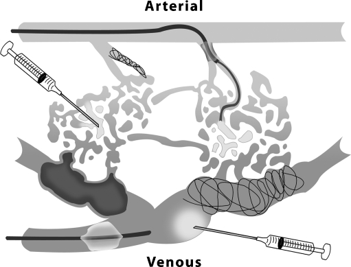 Figure 17