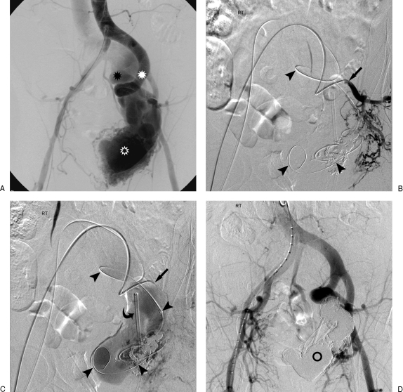 Figure 18