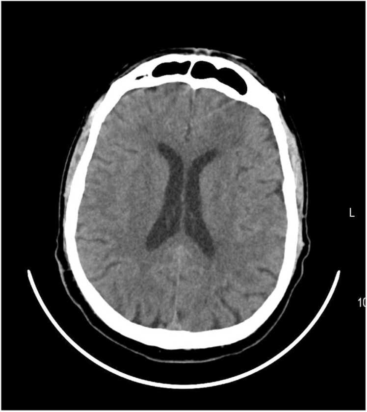 Fig. 1