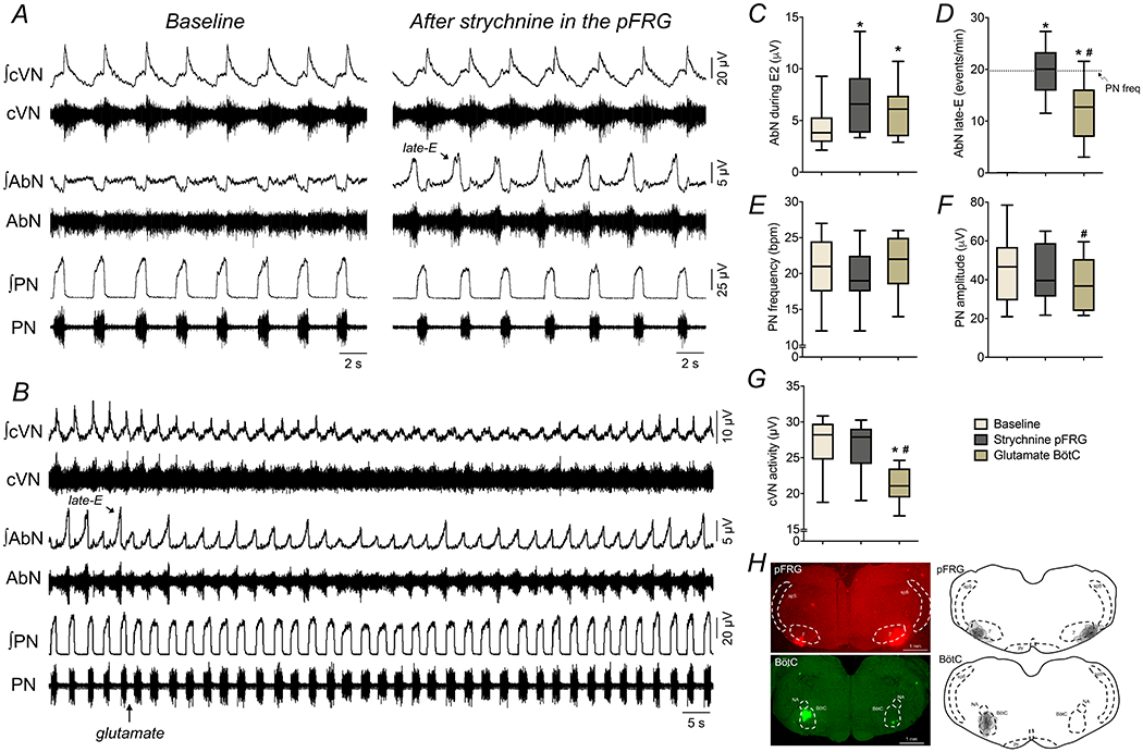 Figure 14.