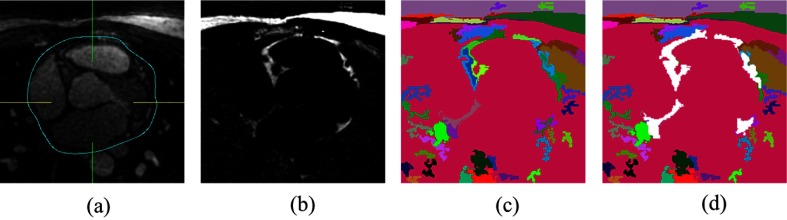 Fig. 2