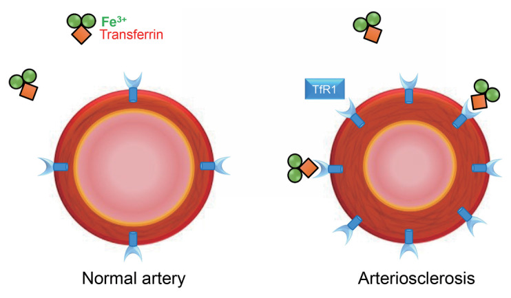 Fig.3. Aortic transferrin receptor 1 in arteriosclerosis