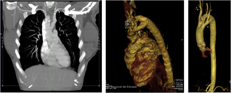 Fig. 3