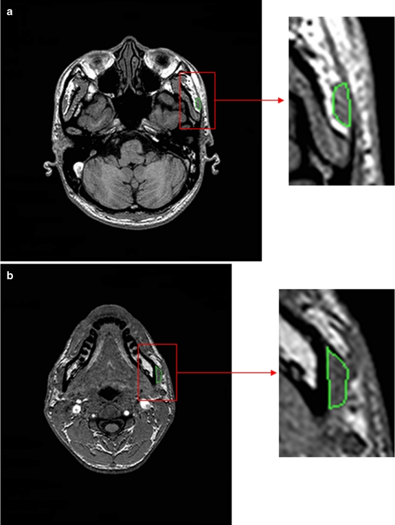 Fig 2