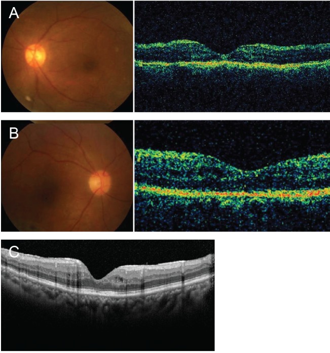 Fig. 4