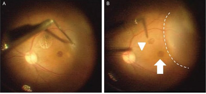 Fig. 2