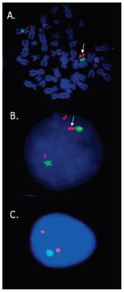 FIG. 3