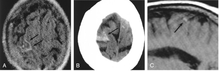 Fig 3.