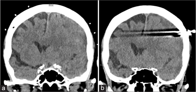 Figure 2: