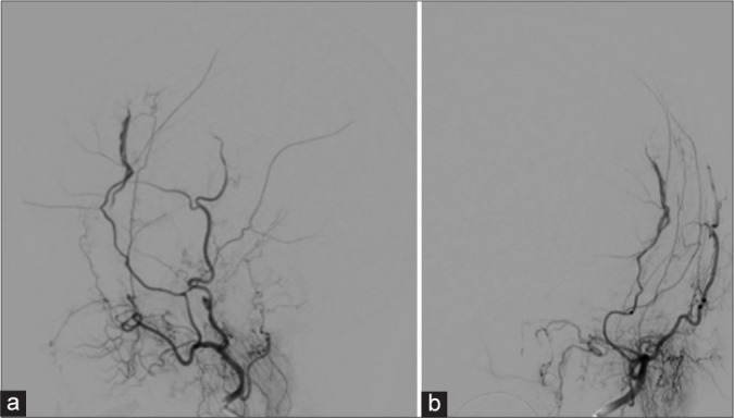 Figure 3: