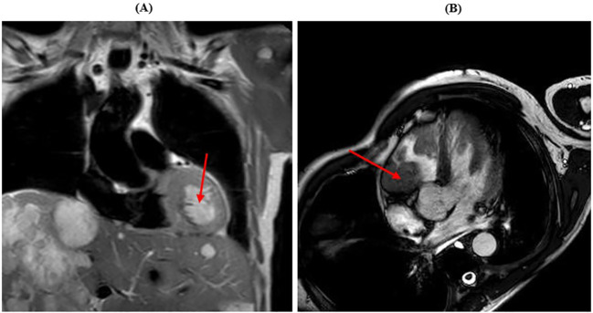 Figure 3