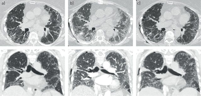 FIGURE 1