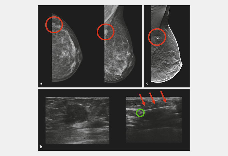 Fig. 1