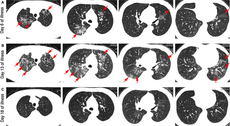 FIGURE 2