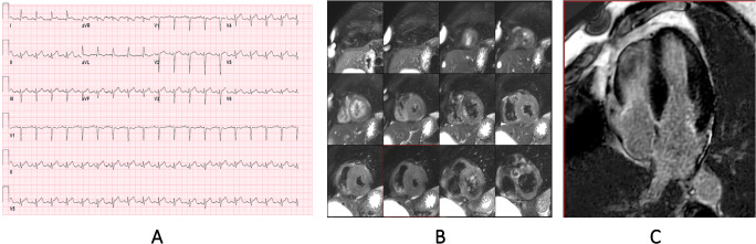 Fig. 3