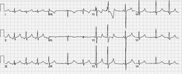 Figure 1: