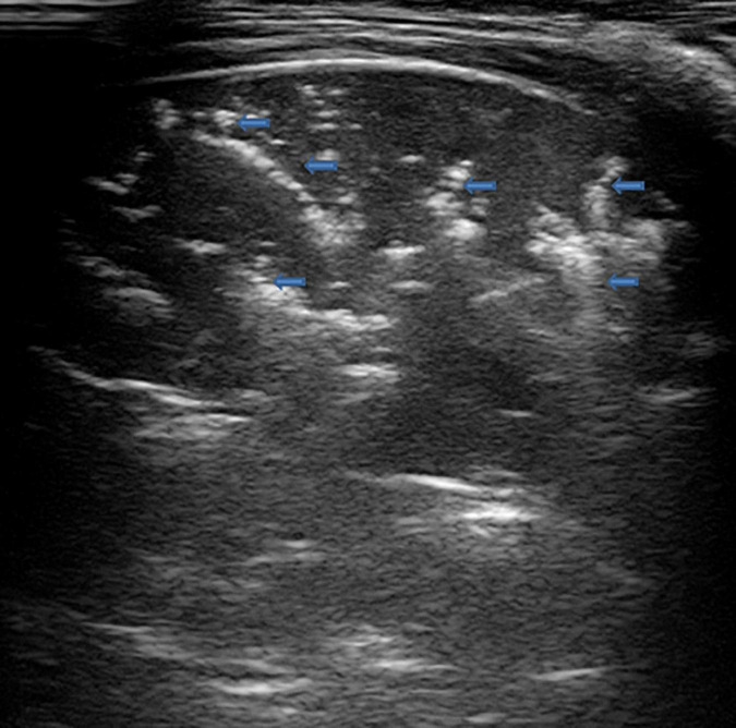 FIGURE 6