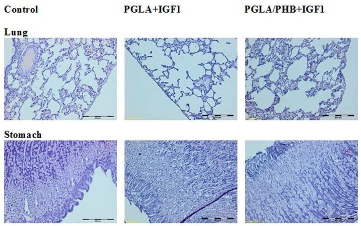 Figure 18