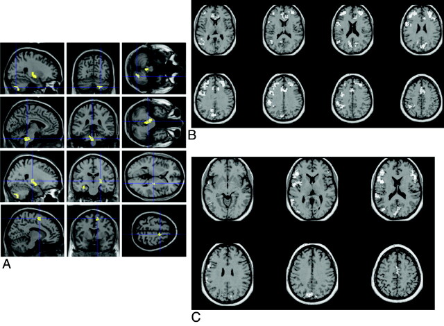 Fig 5.