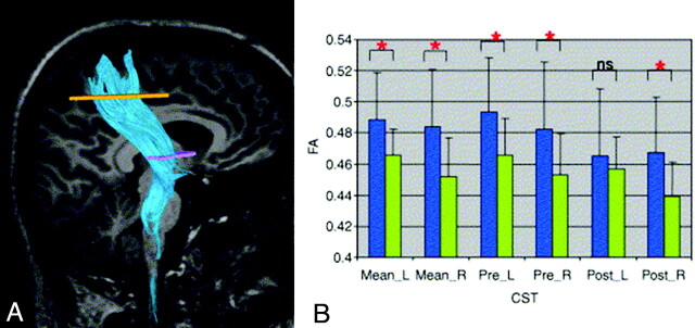 Fig 3.