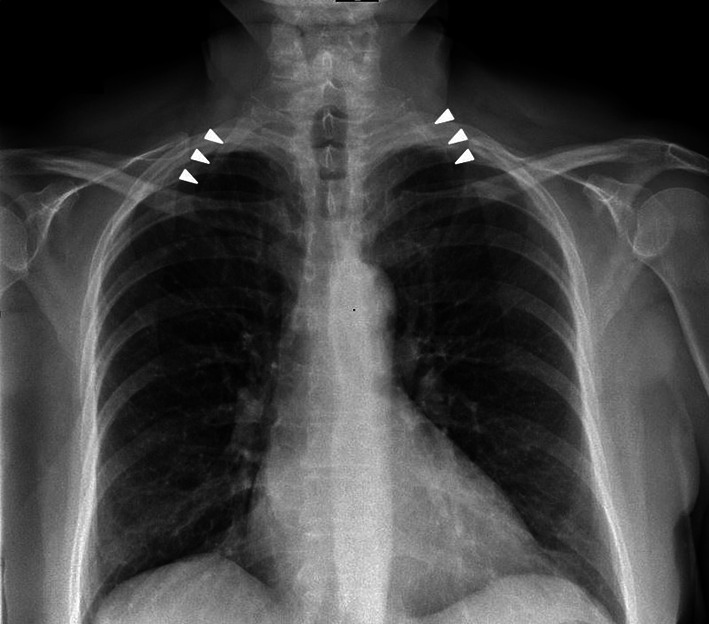 Fig. 1