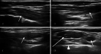 Fig. 6