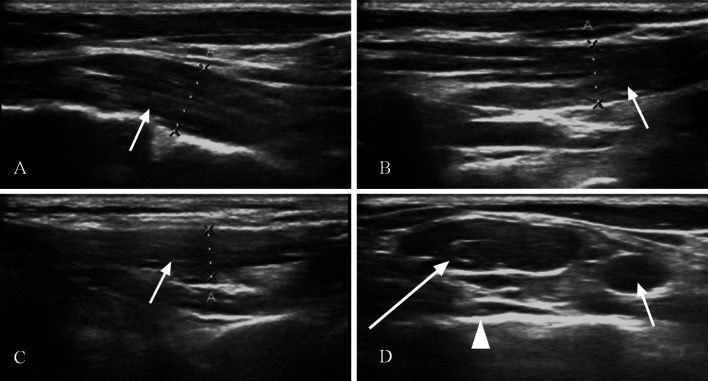 Fig. 6