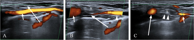 Fig. 3