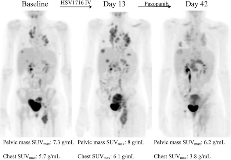 Figure 16