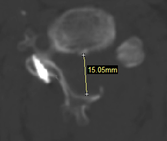 Fig. 2