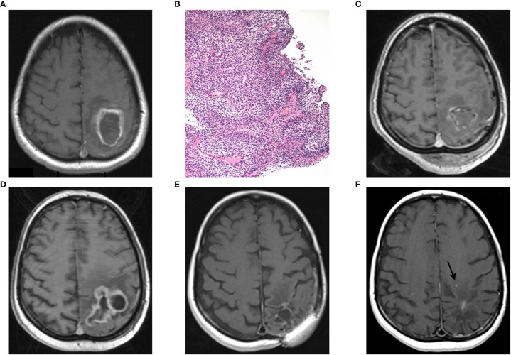 Figure 1