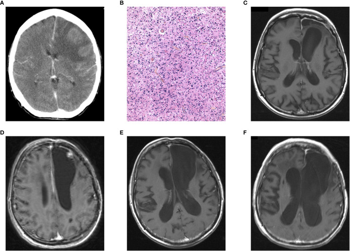 Figure 2