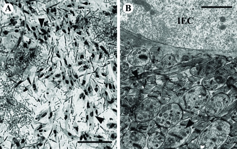 Fig. (1)