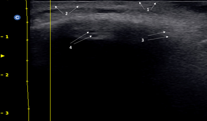 FIGURE 1