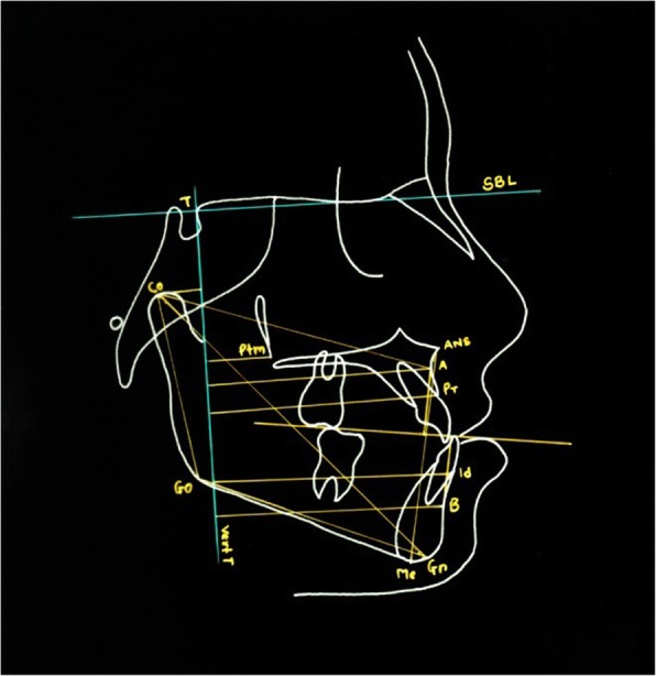 Fig. 4