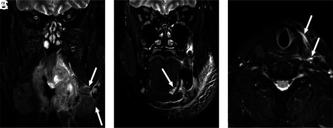 FIG 4.