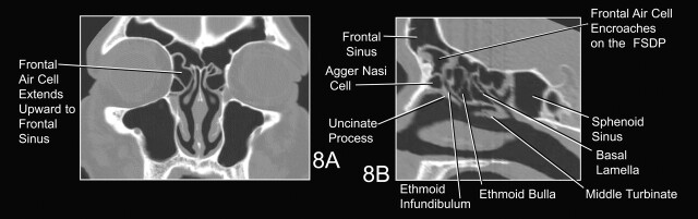 Fig 8.