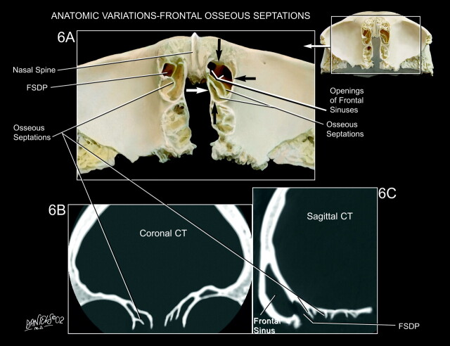 Fig 6.