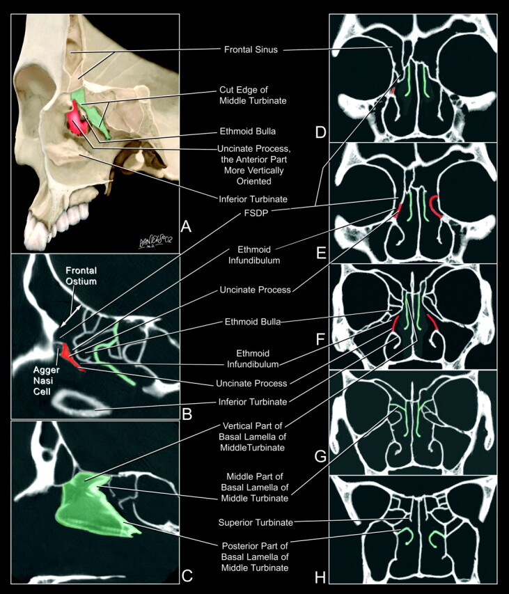 Fig 4.