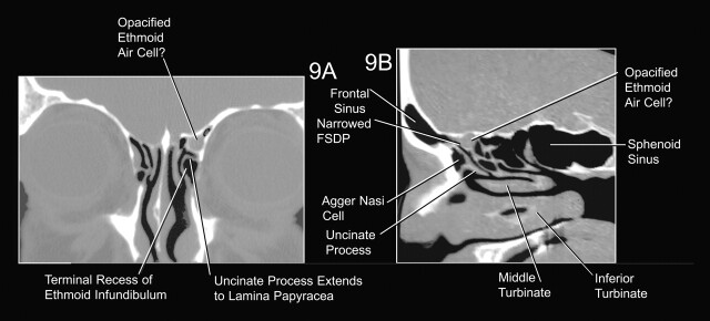 Fig 9.