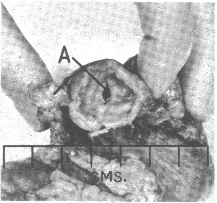 p361-a