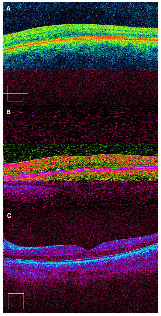 FIG 1