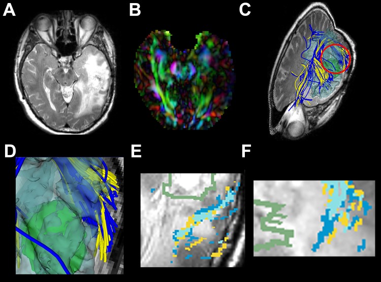 Fig 4